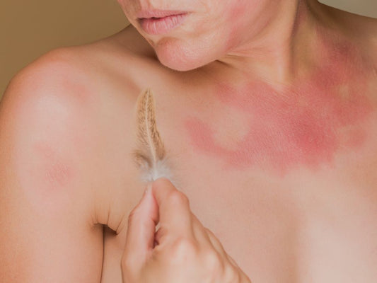 Érzékeny, gyulladásra hajlamos bőr ápolása, mitől lesz hatékony hosszú távon?