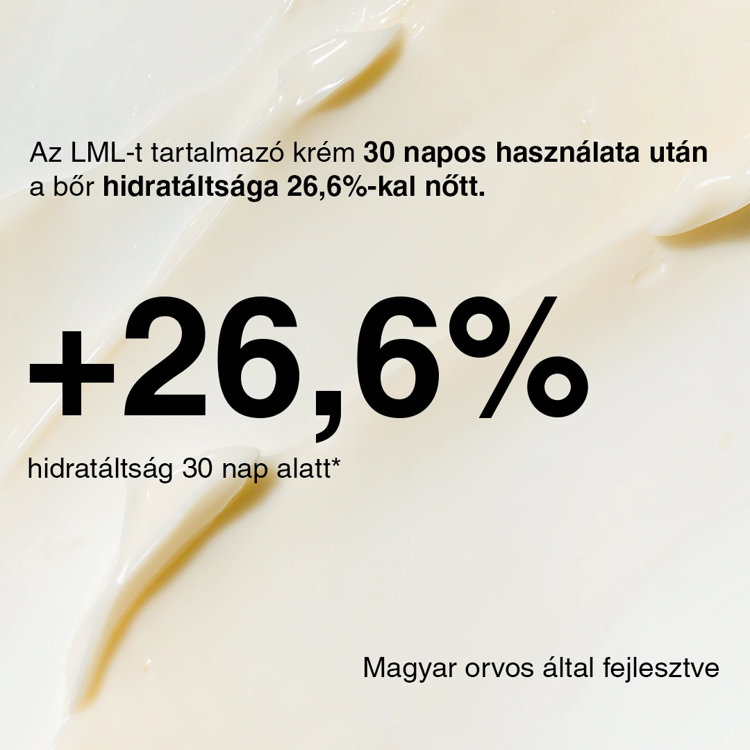 MSM Ízületi Gyulladáscsökkentő Krém Fermentált Hatóanyaggal 150ml